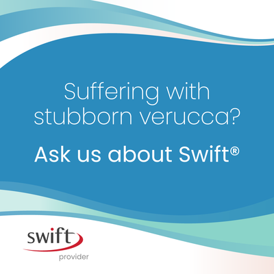 warts & verruca, swift microwave treatment