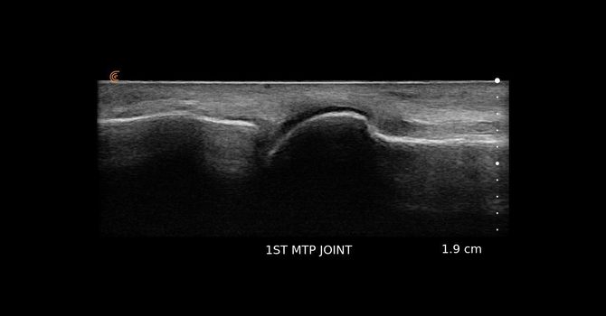 Ultrasound Scanning image